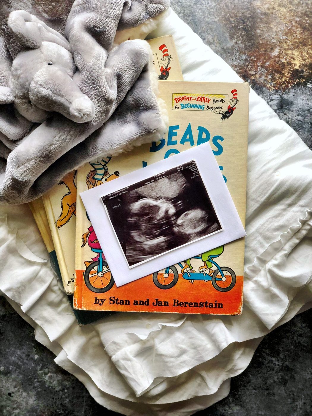 Pregnancy Recap: Weeks 14-18