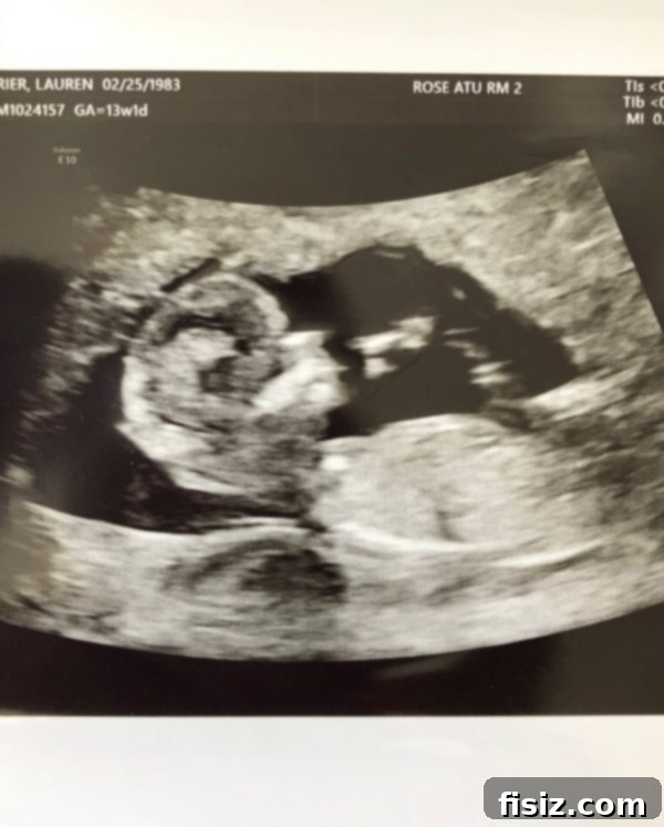 Trimester One The Start of Our Big Adventure 15 Pregnant woman showing a sonogram picture, a moment of happiness and anticipation.