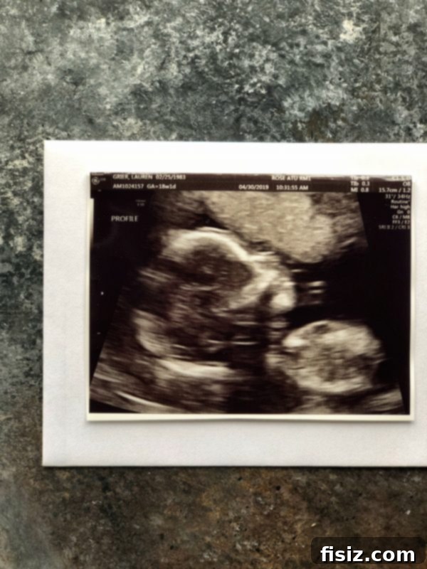 Second Trimester Milestones: My Weeks 14-18 Journey 9 Expecting mother proudly wearing her first pair of maternity jeans